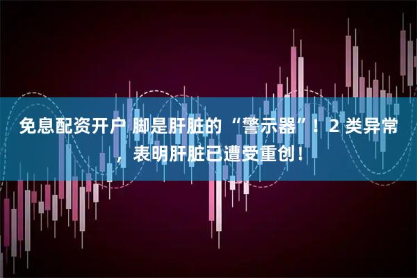 免息配资开户 脚是肝脏的 “警示器”！2 类异常，表明肝脏已遭受重创！